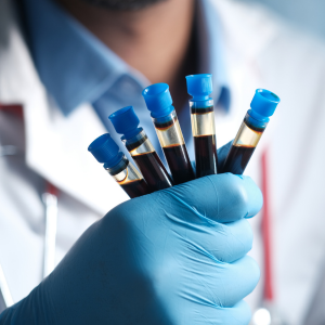 Profesional de salud sosteniendo muestras de sangre para investigación clínica en cancer